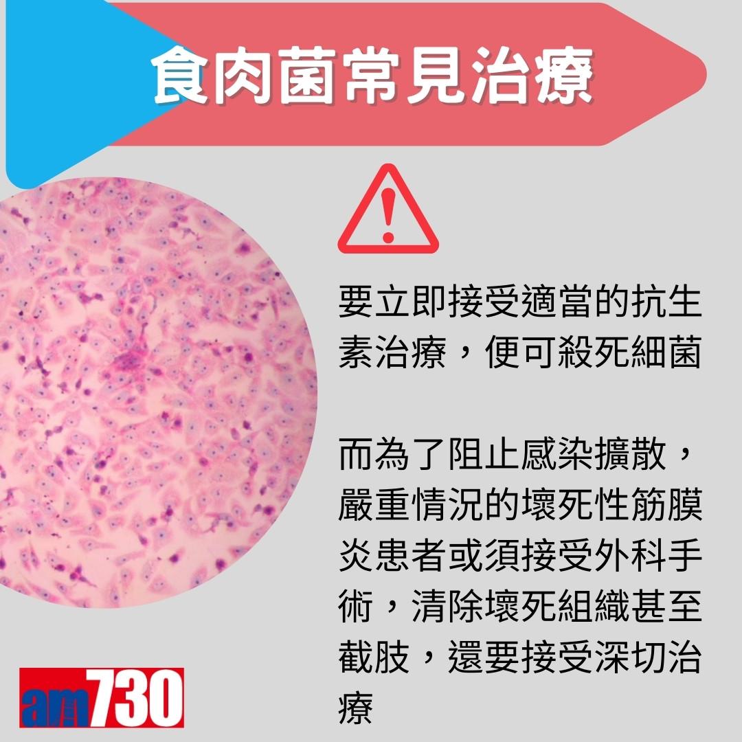 食肉菌症狀、來源及治療方法,嚴重感染需截肢?(am730製圖)
