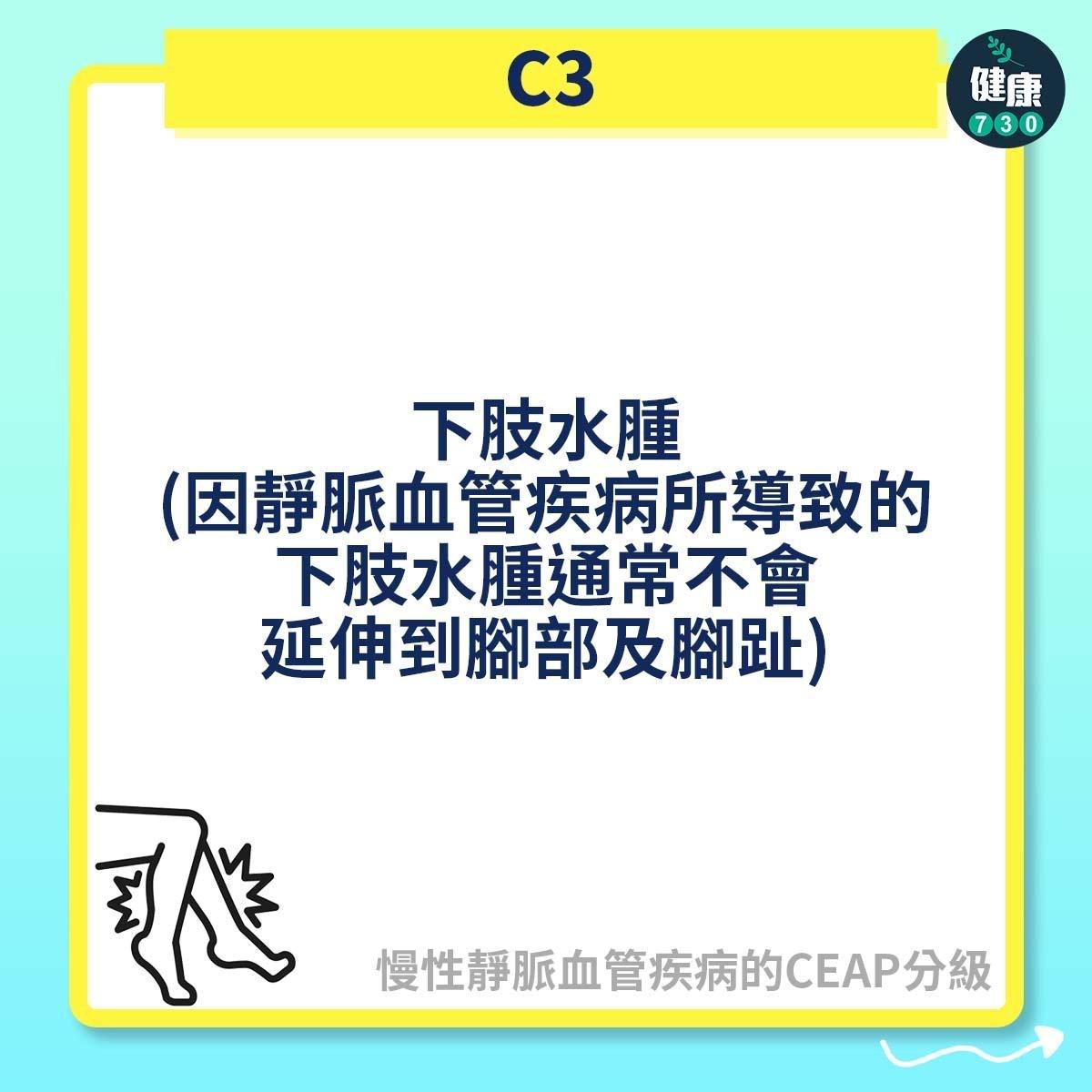 慢性靜脈血管疾病的CEAP分級,C2屬靜脈曲張(am730製圖)