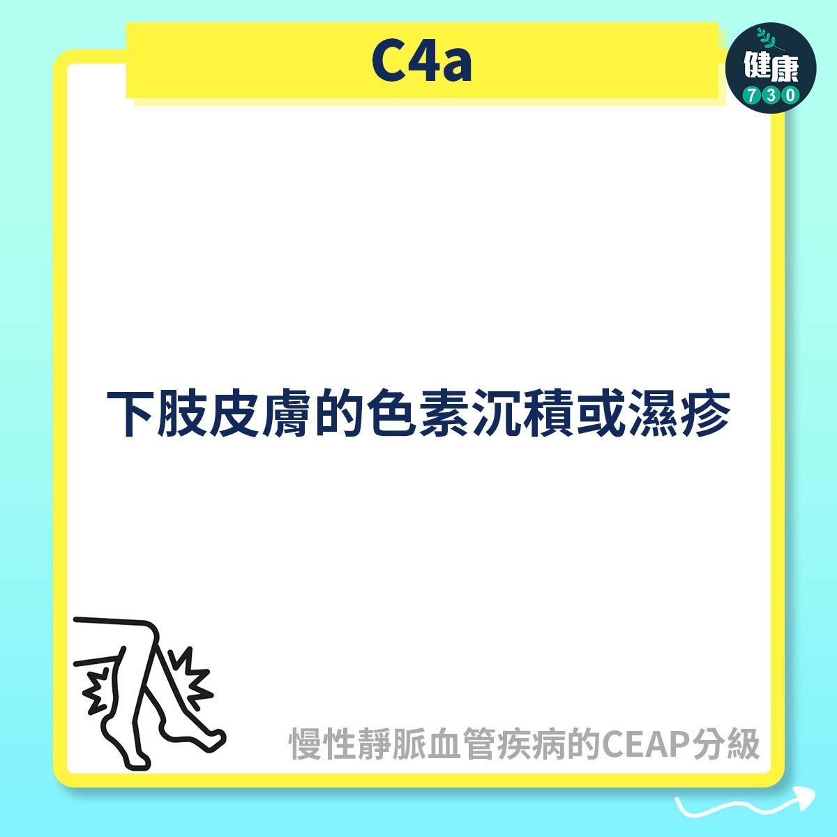 慢性靜脈血管疾病的CEAP分級,C2屬靜脈曲張(am730製圖)