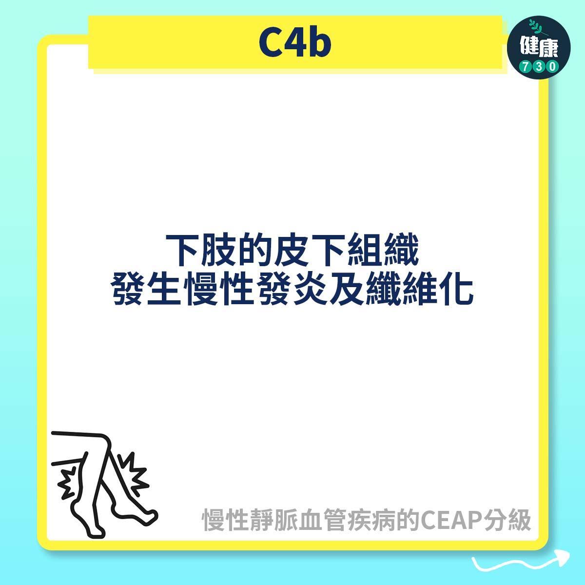 慢性靜脈血管疾病的CEAP分級,C2屬靜脈曲張(am730製圖)