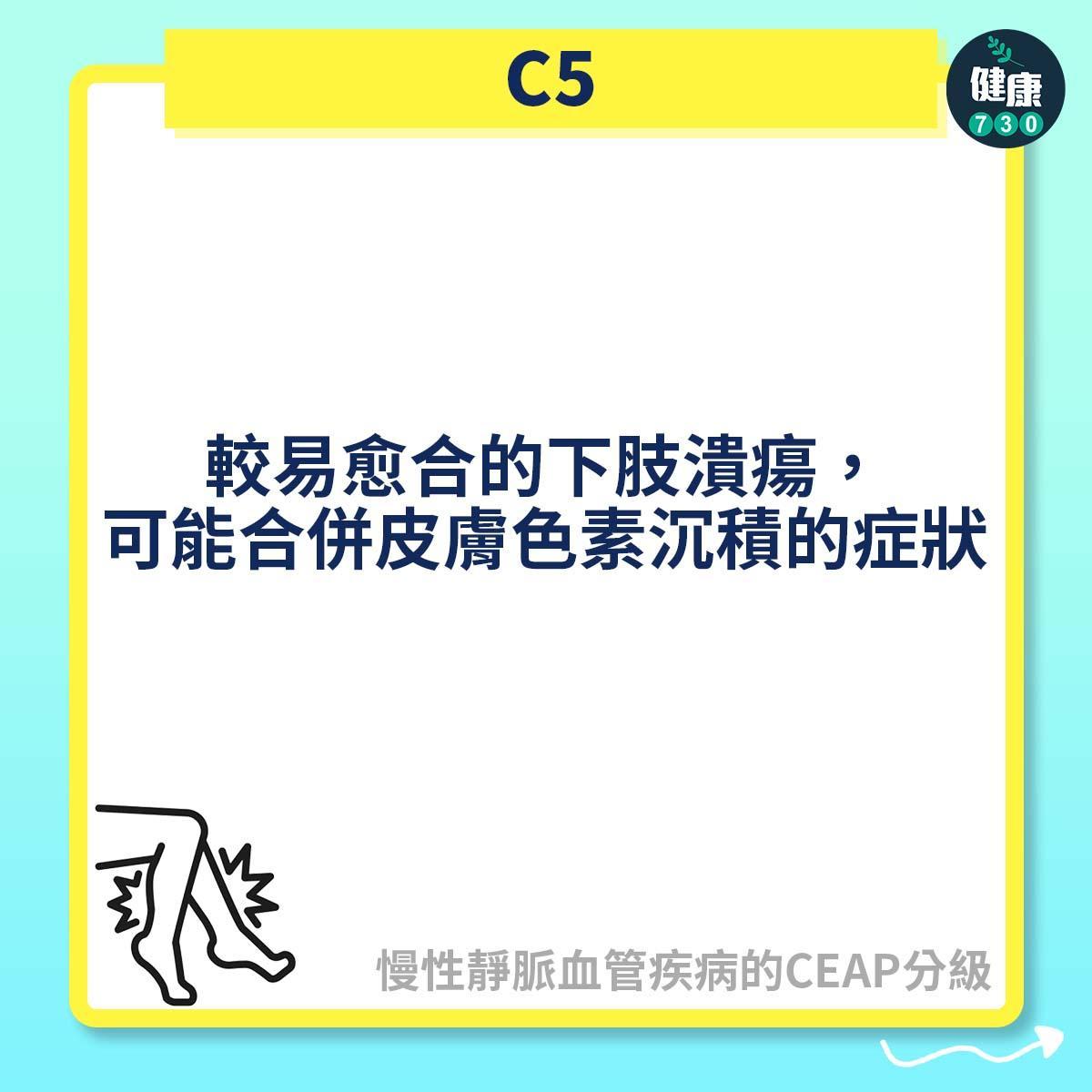 慢性靜脈血管疾病的CEAP分級,C2屬靜脈曲張(am730製圖)