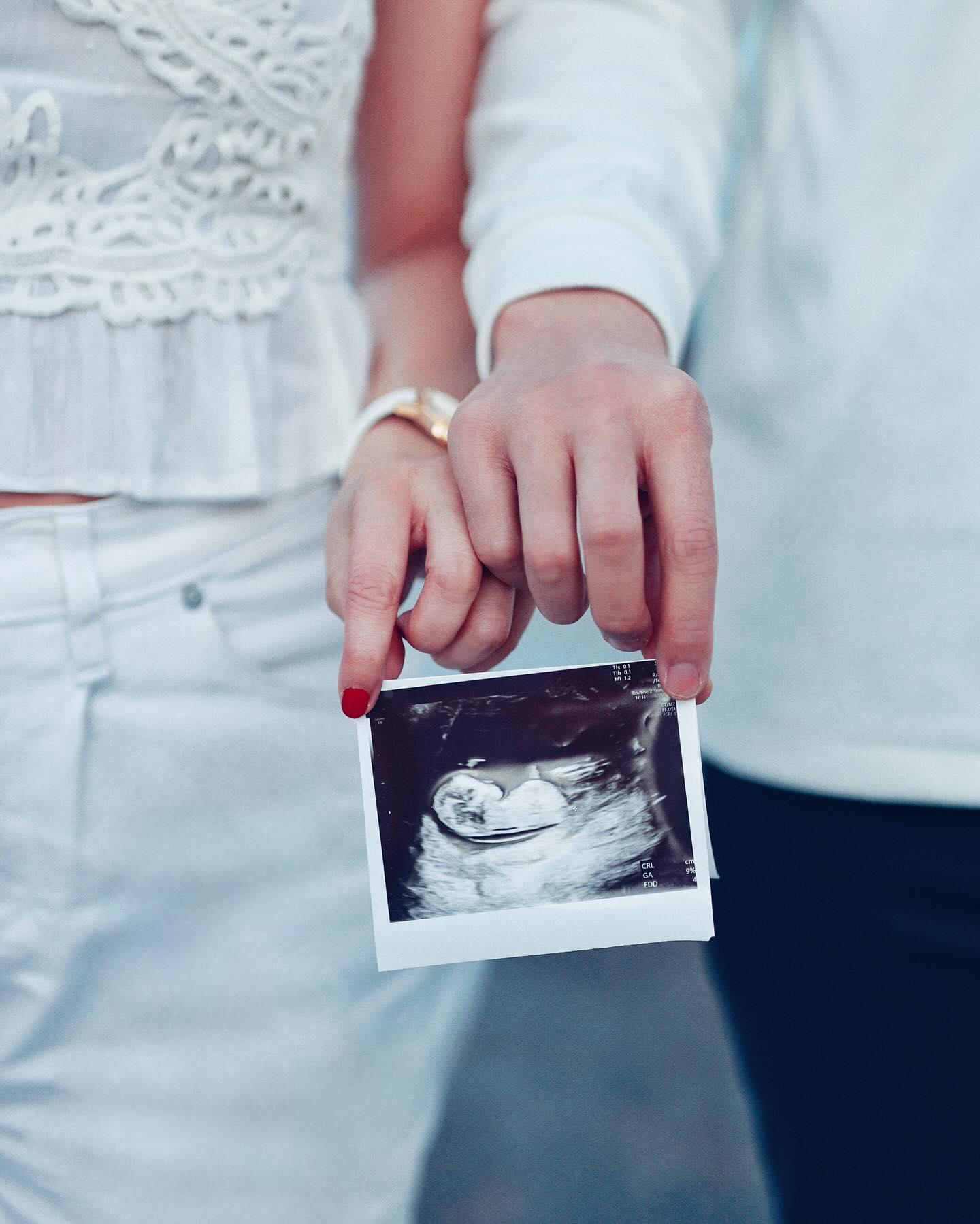 Phil與太太在社交網貼出超聲波照。