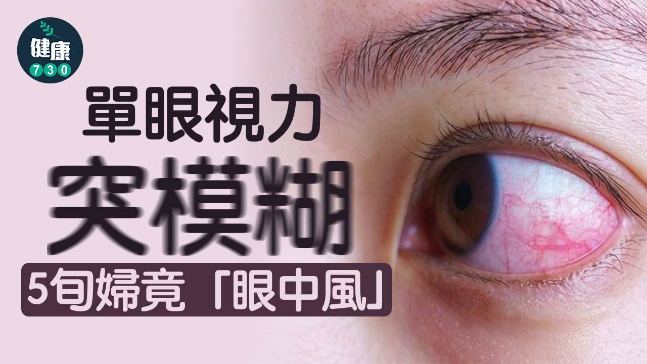 單眼視力突模糊 5旬婦竟「眼中風」
