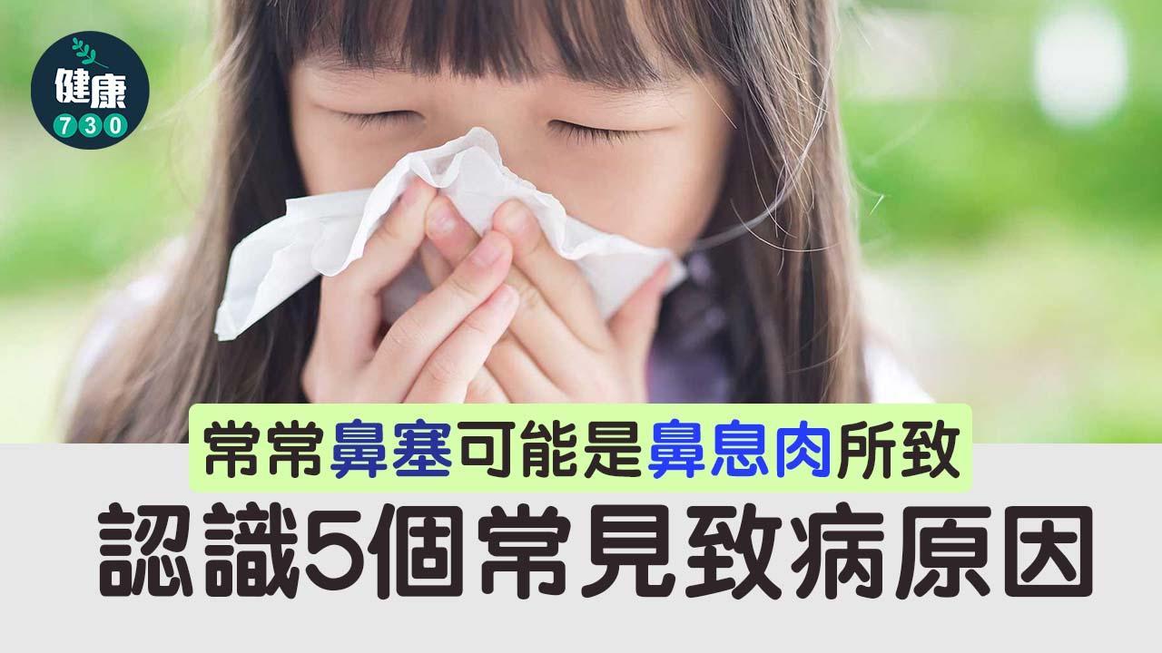 鼻塞原因|哮喘、慢性鼻竇炎、藥物敏感、過敏性鼻炎都可能是成因。(am730製圖)