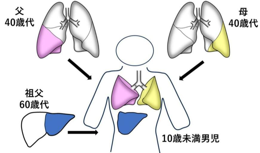 手術在去年11月進行,院方將男童40多歲父母的一部份肺部,以及他60多歲祖父的肝臟一部份,同時移植給男童。(京都大學醫院圖片)