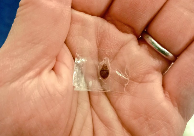 有網民接連在社交平台X上載圖片,指發現座位上有疑似床蝨亂爬。