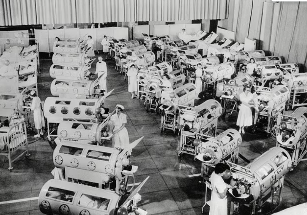 當年醫院的「鐵肺」。(互聯網)