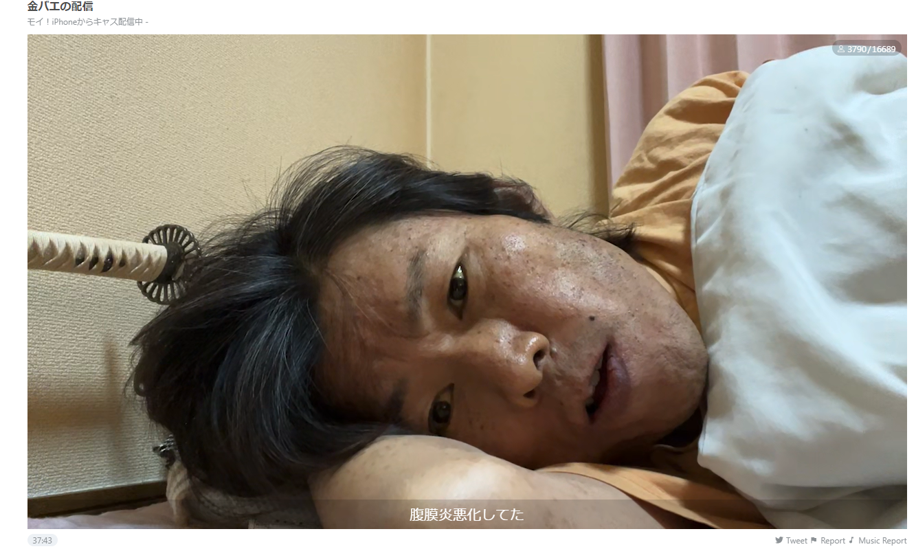 Kimbae周二直播,說腹膜炎情況轉差。(互聯網)