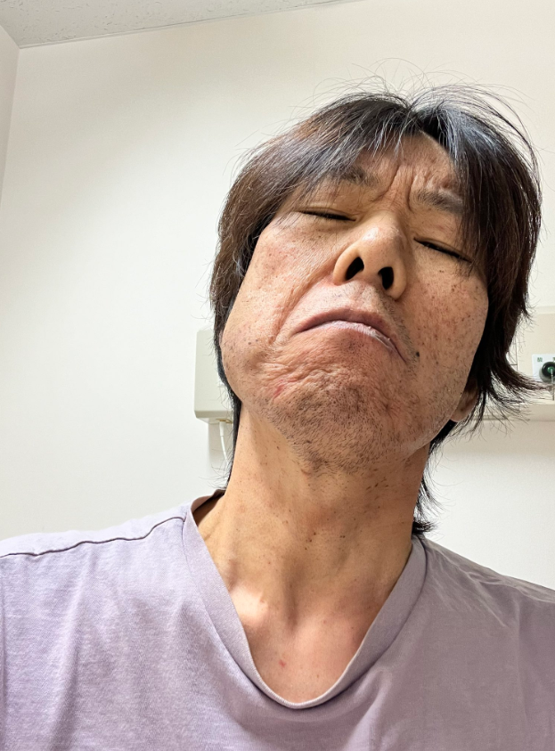 Kimbae病情嚴重,氣色欠佳。(互聯網)