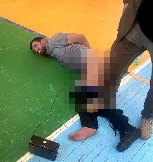 社交平台流傳照片,可見其中一名槍手被審問期間疑遭酷刑,生殖器受到電擊