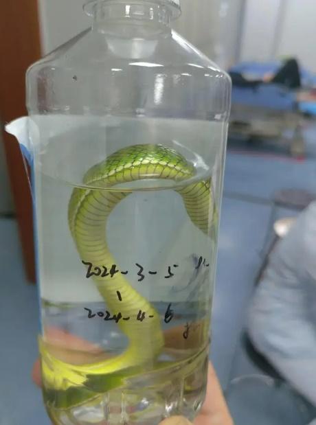 醫生判定那蛇是含劇毒的青竹蛇。(微博)
