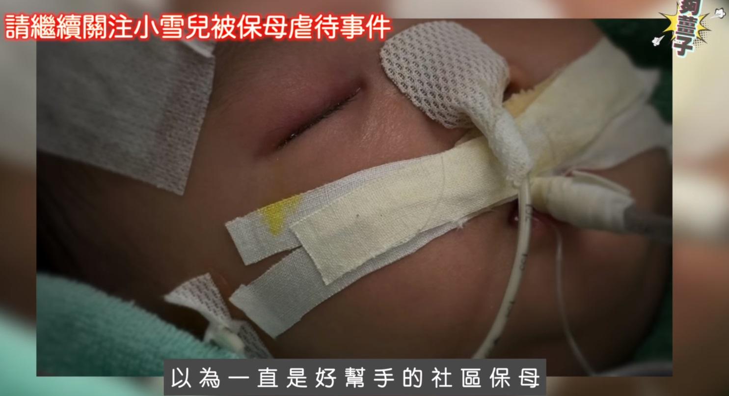 屯門虐嬰案|小雪兒父母交代女嬰情況,指女兒永久傷殘和癱瘓,而且很大機會失明。 (夠薑子呂校長l貓貓校監lfb影片截圖)