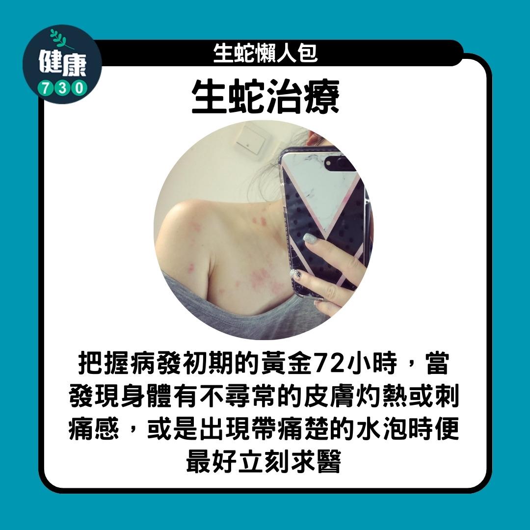 生蛇懶人包,生蛇治療(am730製圖)