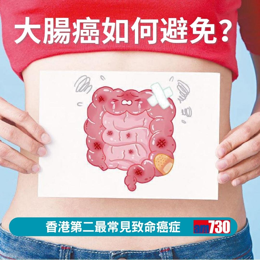 大腸癌症狀、先兆、治療及預防方法(am730製圖)