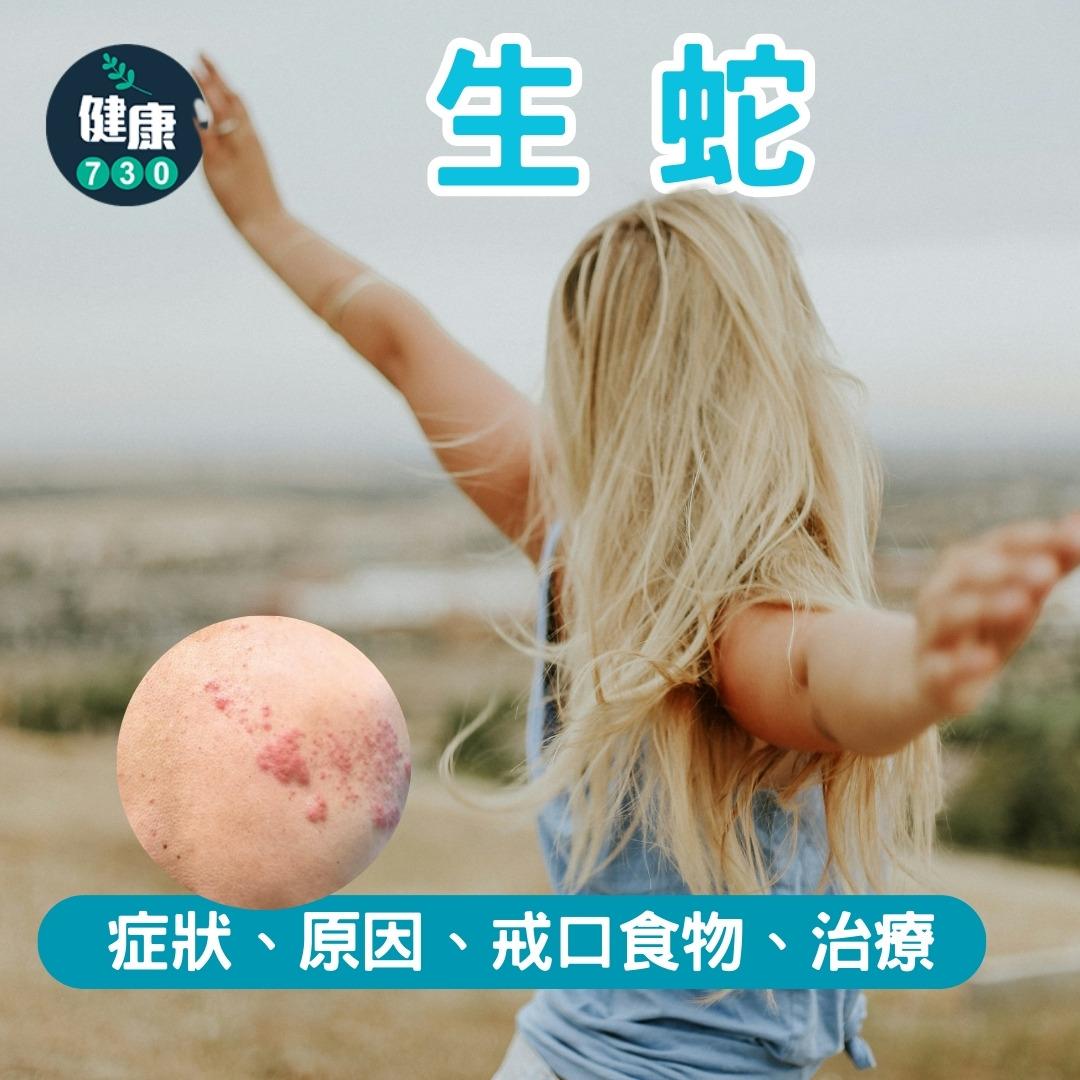 生蛇懶人包,症狀、原因、戒口食物、治療(am730製圖)