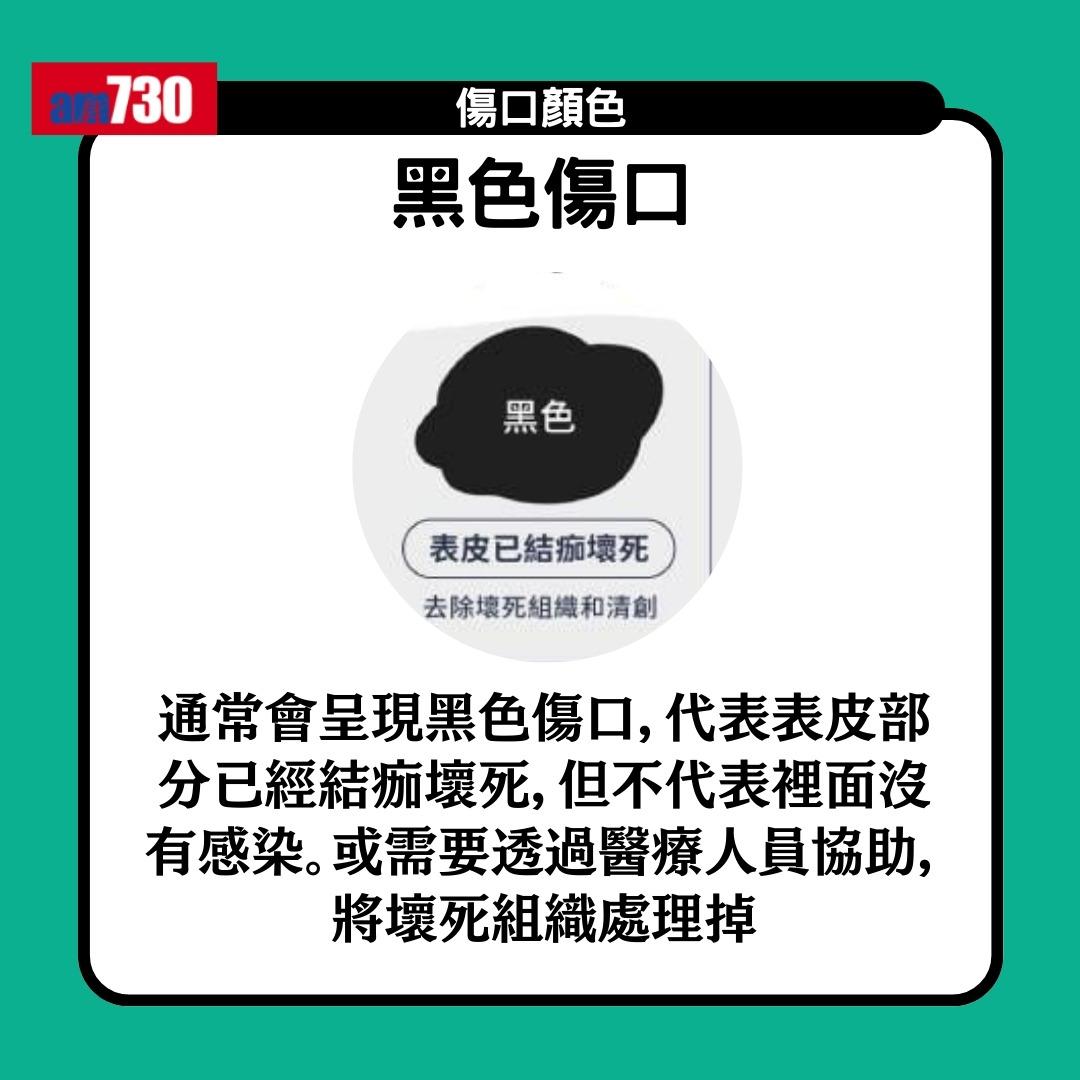 傷口顏色|紅黃綠黑有咩唔同?小心處理加速癒合時間(am730製圖)