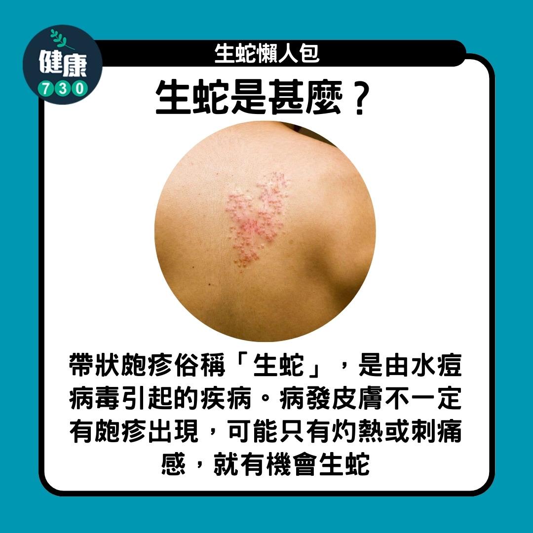 生蛇懶人包,生蛇是甚麼?(am730製圖)