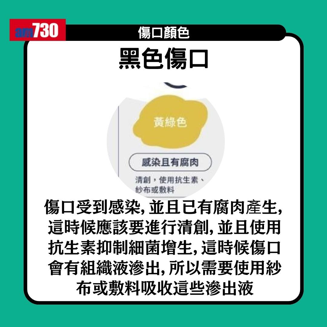 傷口顏色|紅黃綠黑有咩唔同?小心處理加速癒合時間(am730製圖)