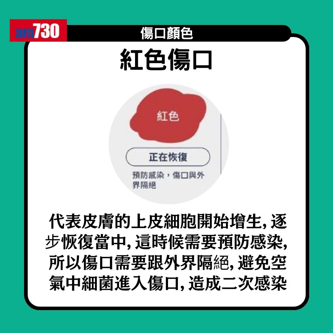 傷口顏色|紅黃綠黑有咩唔同?小心處理加速癒合時間(am730製圖)