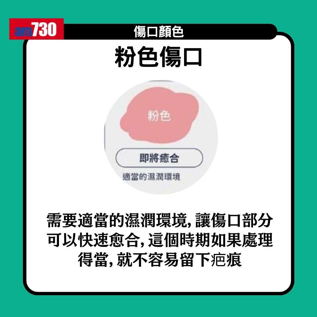 傷口顏色|紅黃綠黑有咩唔同?小心處理加速癒合時間(am730製圖)