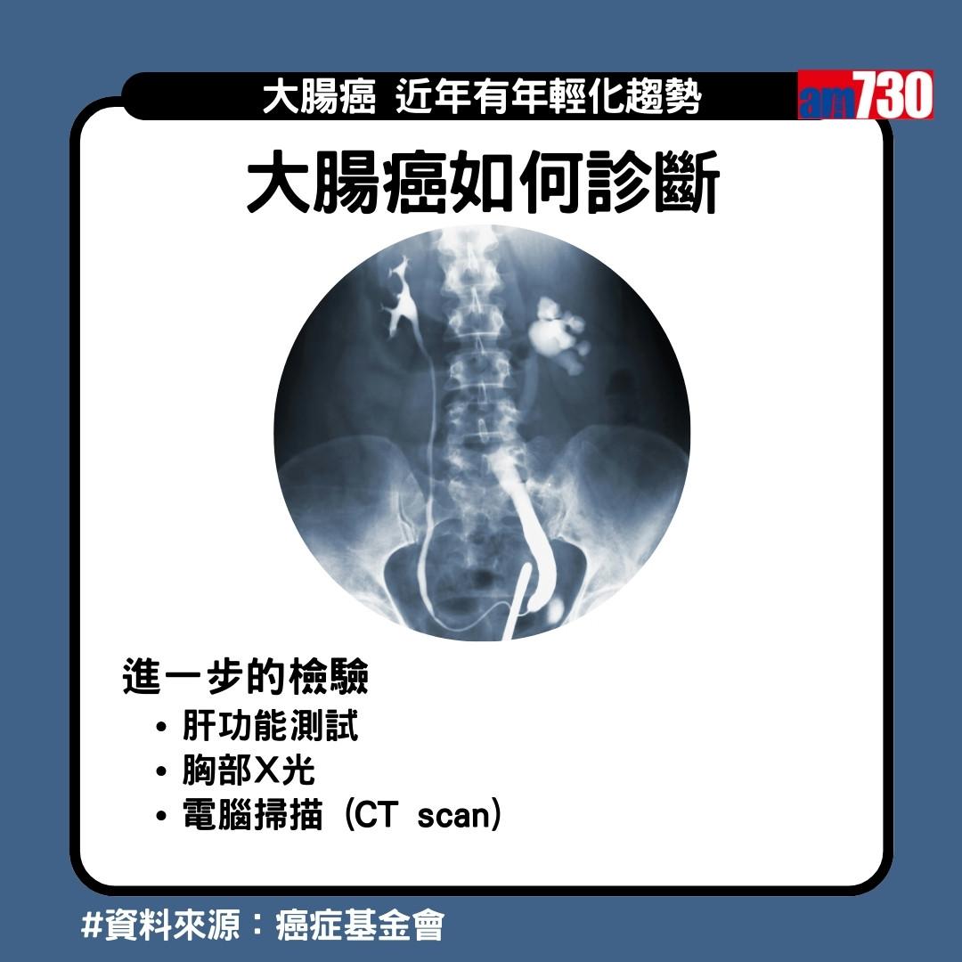 大腸癌症狀、先兆、治療及預防方法(am730製圖)