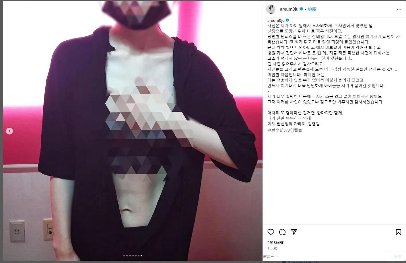 雅凜發文揭露前夫家暴行徑。(圖/翻攝自雅凜IG)