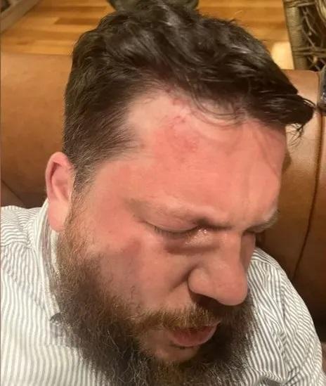 沃科夫遇襲後的相片。(網上圖片)