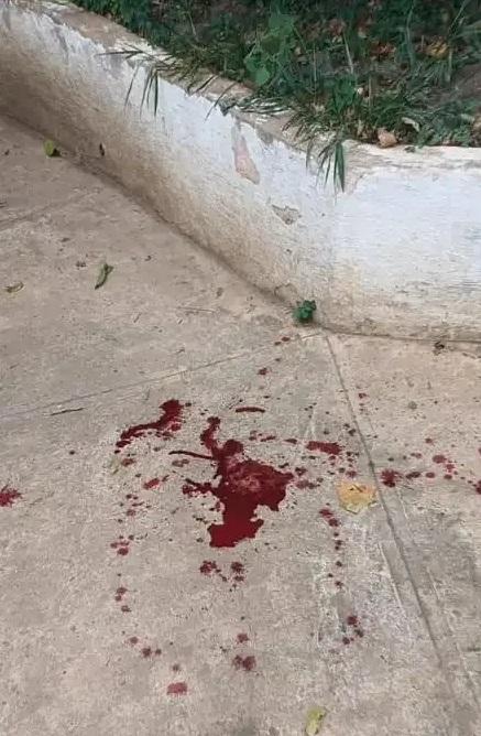 地上留下血漬。(互聯網)