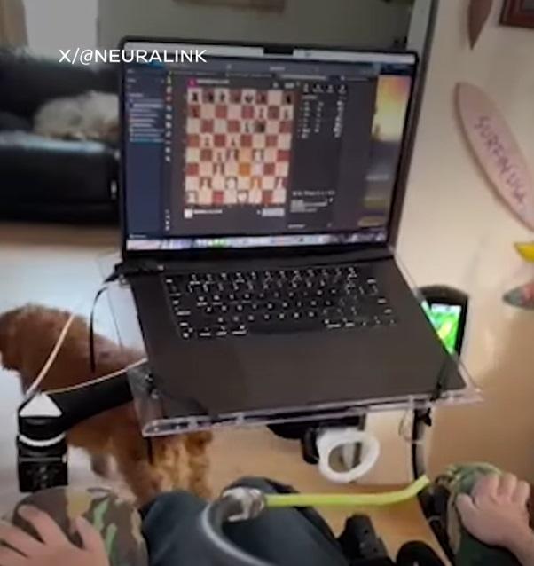 阿博在直播中展示如何運用意念控制滑鼠的游標,上網下棋。(互聯網)