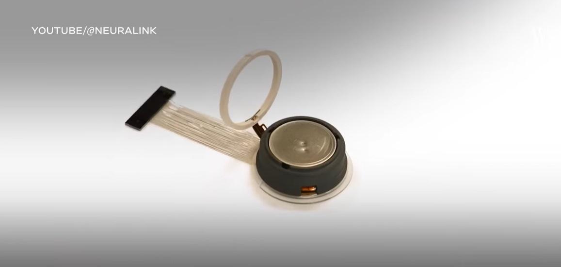 植入阿博腦部的晶片裝置。(互聯網)