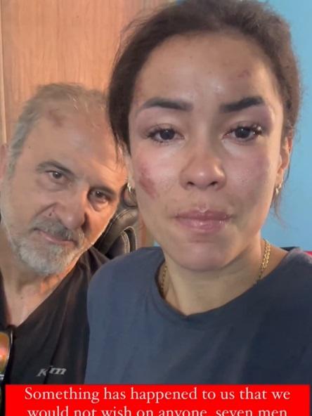 南達與丈夫案發後上傳受傷照片。(互聯網)