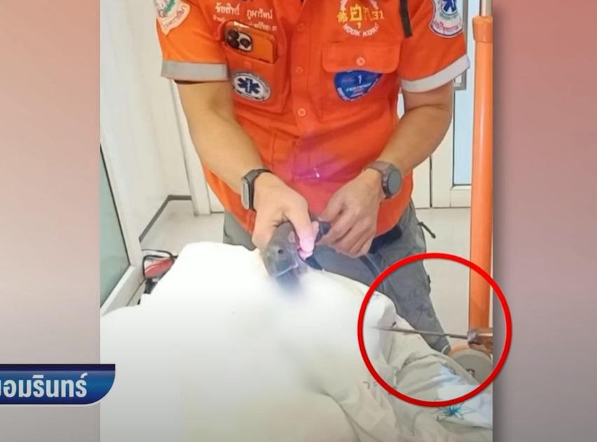 消防員先將魚叉長桿切除。(互聯網)