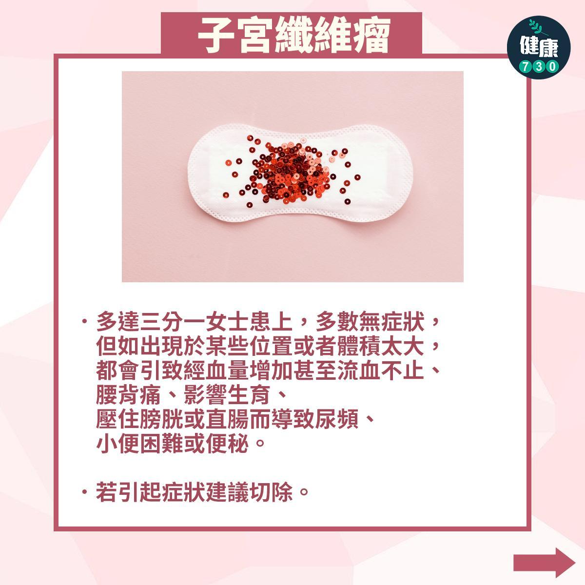 常見婦科疾病|子宮纖維瘤(am730製圖)