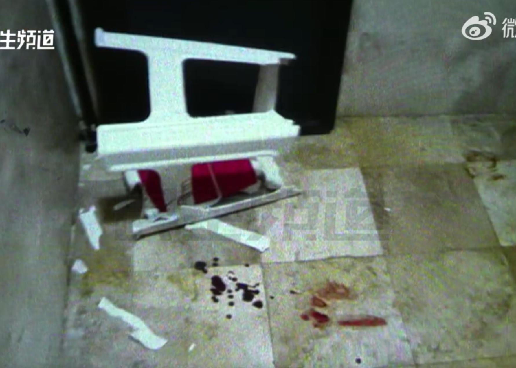 事主坐醫院洗手間膠凳突破碎,「陰囊割破」慘縫20多針。