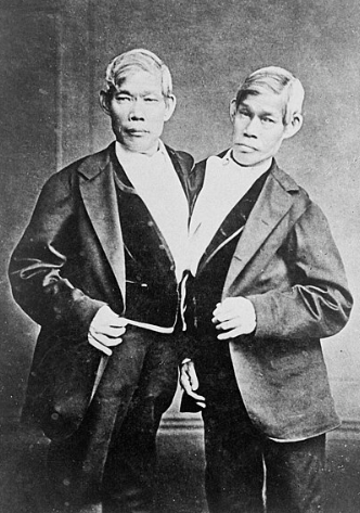 「暹羅雙胞胎」恩格和常克邦克(Eng & Chang Bunker )。(互聯網)