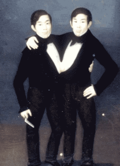 「暹羅雙胞胎」恩格和常克邦克(Eng & Chang Bunker )。(互聯網)