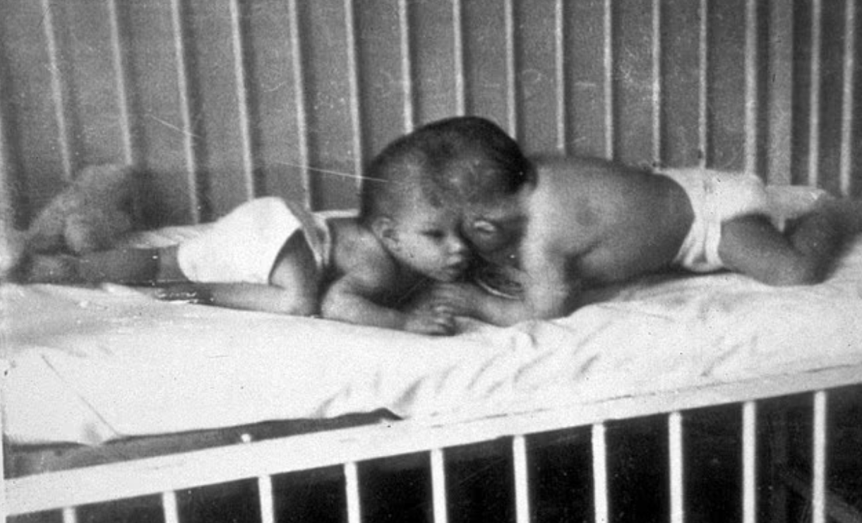 洛莉及喬治出生時模樣。(互聯網)