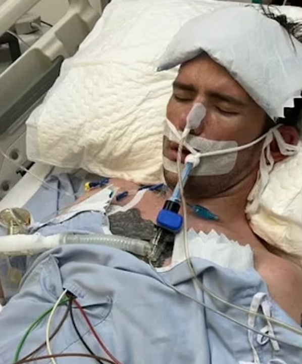 威爾金斯陷入昏迷。(互聯網)