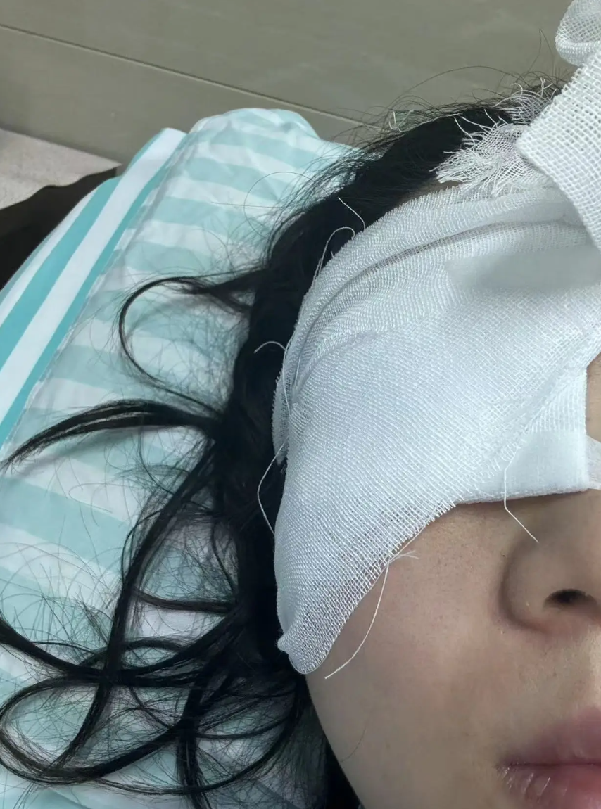 內地一名女子於潑水節期間前往雲南省西雙版納州告莊景區遊玩,期間被人用高壓水槍噴射,導致右眼受傷,一度感覺到失明,要住院治療。