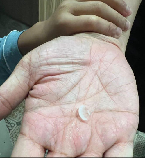 澳門落冰雹(網上圖片)