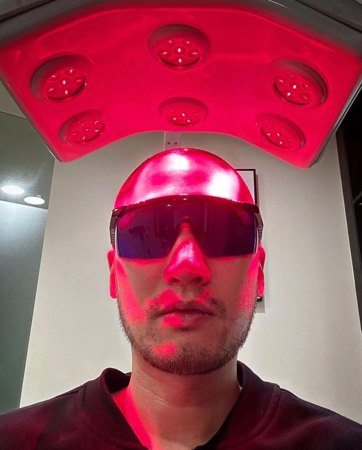 賴弘國去年鼓起勇氣植髮。