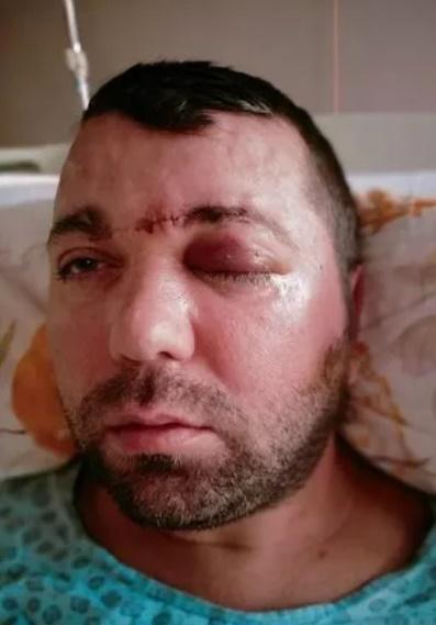 事主住院期間。(網上圖片)