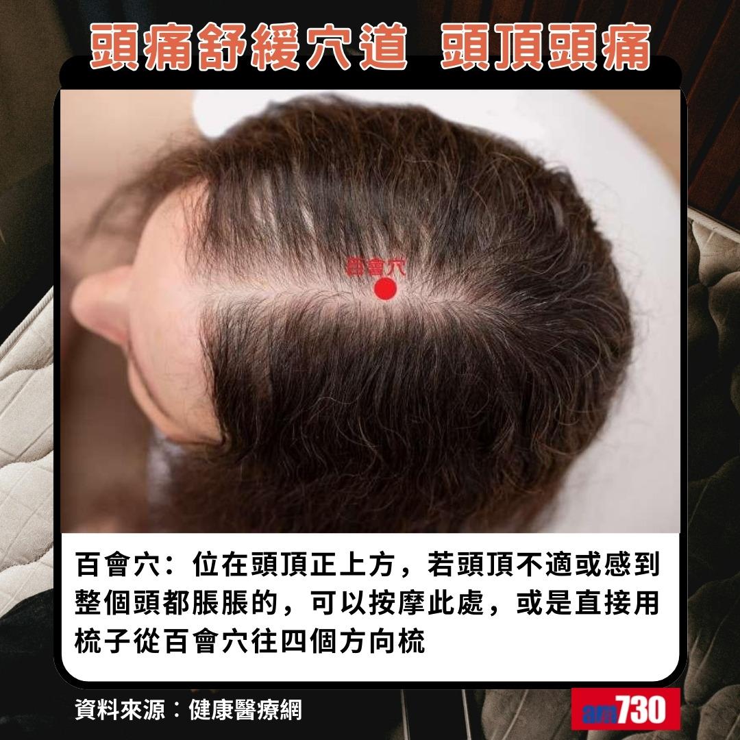 頭痛舒緩穴道|頭頂頭痛,百會穴(am730製圖)