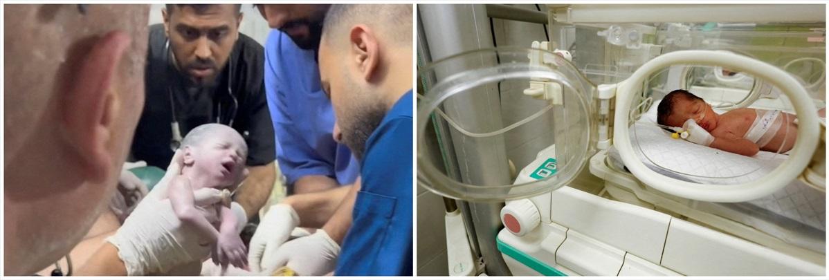 孕婦命喪以軍襲擊,醫生們緊急剖腹從子宮取出女嬰,再放於保溫箱照料。(路透社)