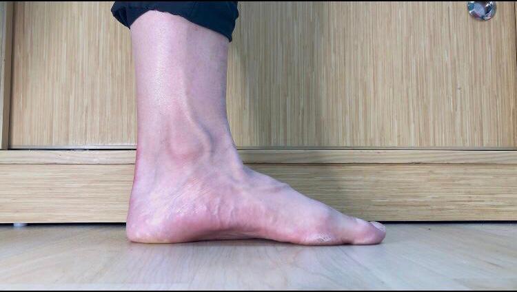在家也能做的舒緩治療運動,縮足運動 (Short Foot)後 (注意腳掌長和足弓高度的變化)