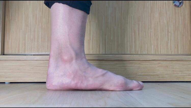 在家也能做的舒緩治療運動,縮足運動 (Short Foot)前