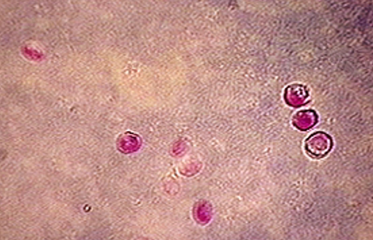 顯微鏡下的隱孢子蟲。(互聯網)