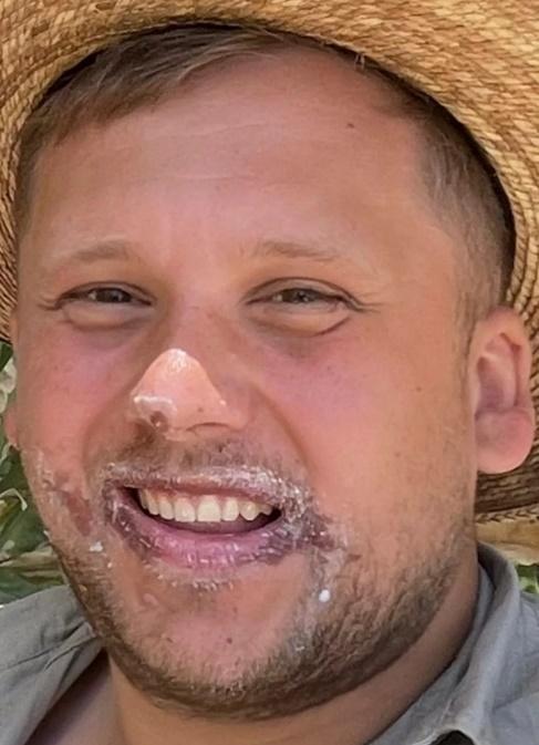 他提供的照片顯示,圍著他咀的皮膚正脫皮,另一張相可見他咀角兩側有相當明顯的深色痕跡。(dailymotion)