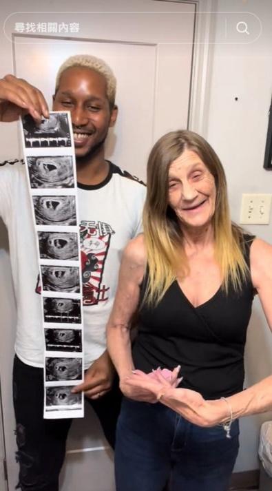 相差37年婆孫戀,63歲婦與嫩夫喜曬超聲波相宣布成功造人。(TikTok)