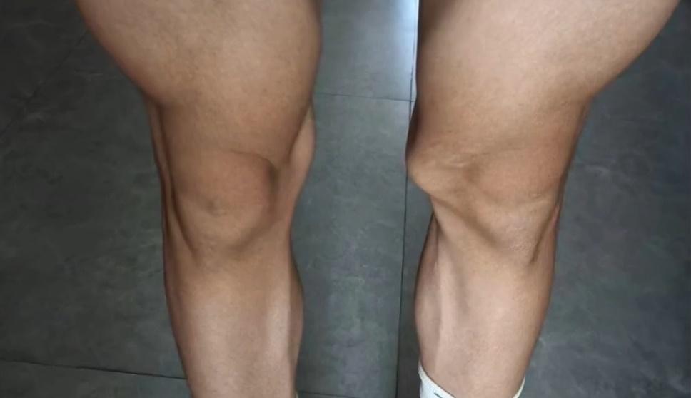 事主手術前。(微博)